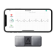 AliveCor KardiaMobile เครื่องตรวจคลื่นไฟฟ้าหัวใจ EKG แบบพกพา เชื่อมต่อสมาร์ทโฟน