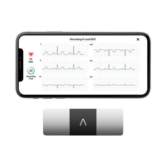 AliveCor KardiaMobile 6L เครื่องตรวจคลื่นไฟฟ้าหัวใจ (ชนิด 6 ลีด) แบบพกพา